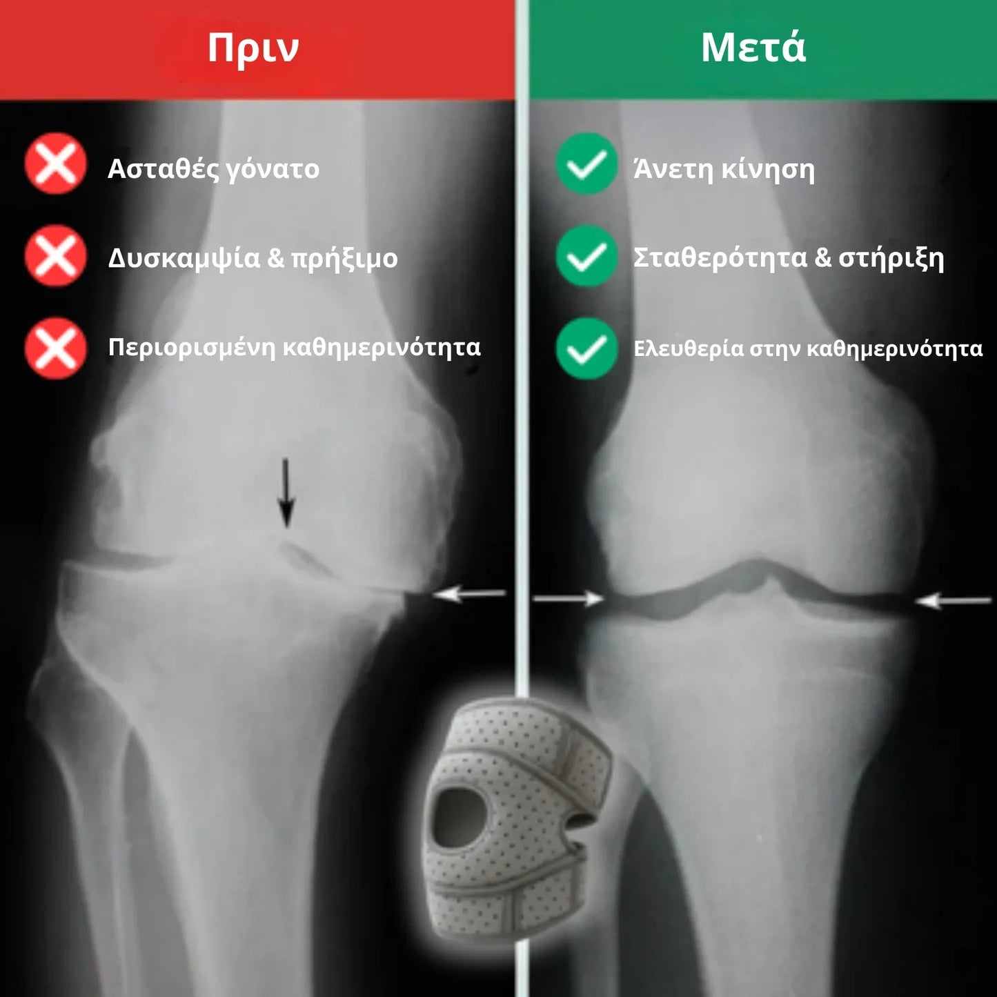 Επιγονατίδα ροτούλας IKEROS™