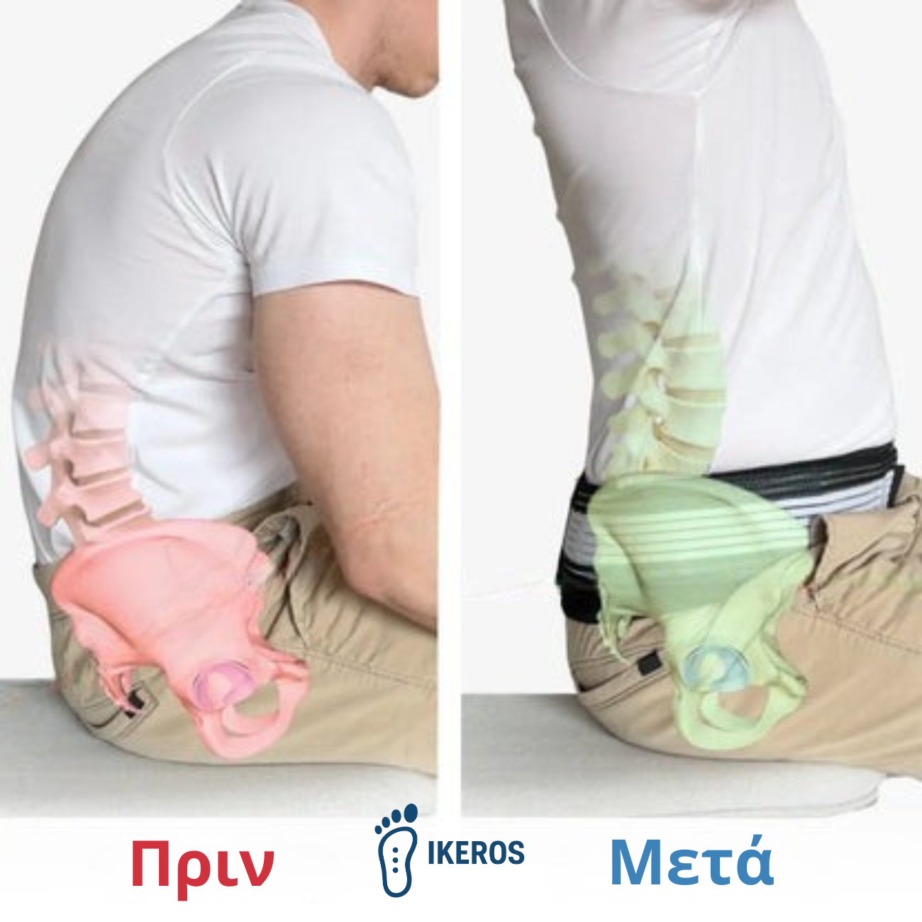 Ορθοπεδική Ζώνη IKEROS™ Υποφέρετε από ισχιαλγία ή πόνους στη μέση;